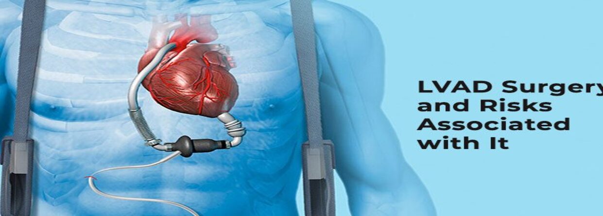 LVAD Surgery and Risks Associated with It